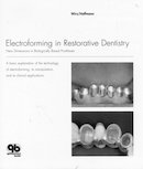 electroform_dentistry